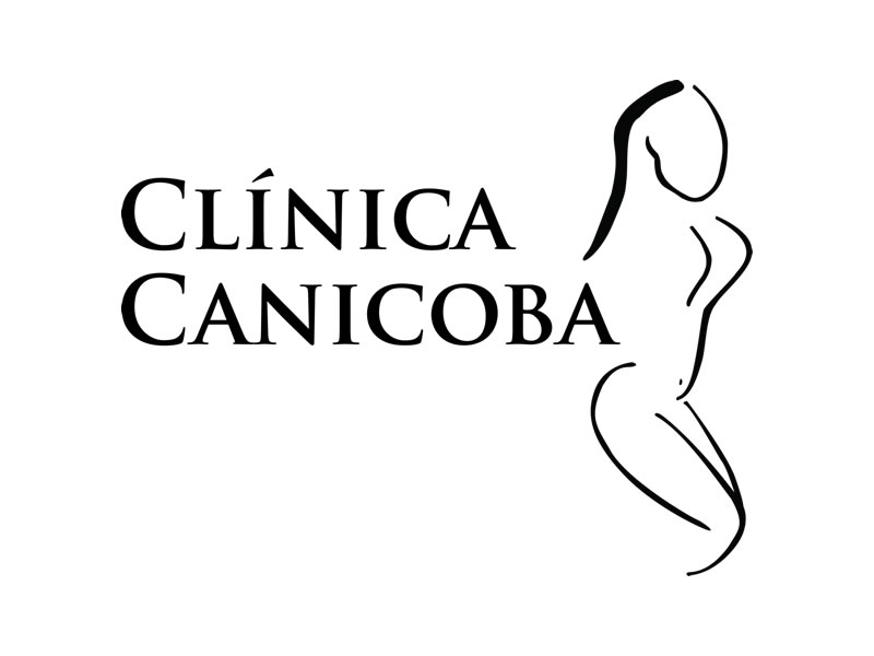 Reduo de Areola